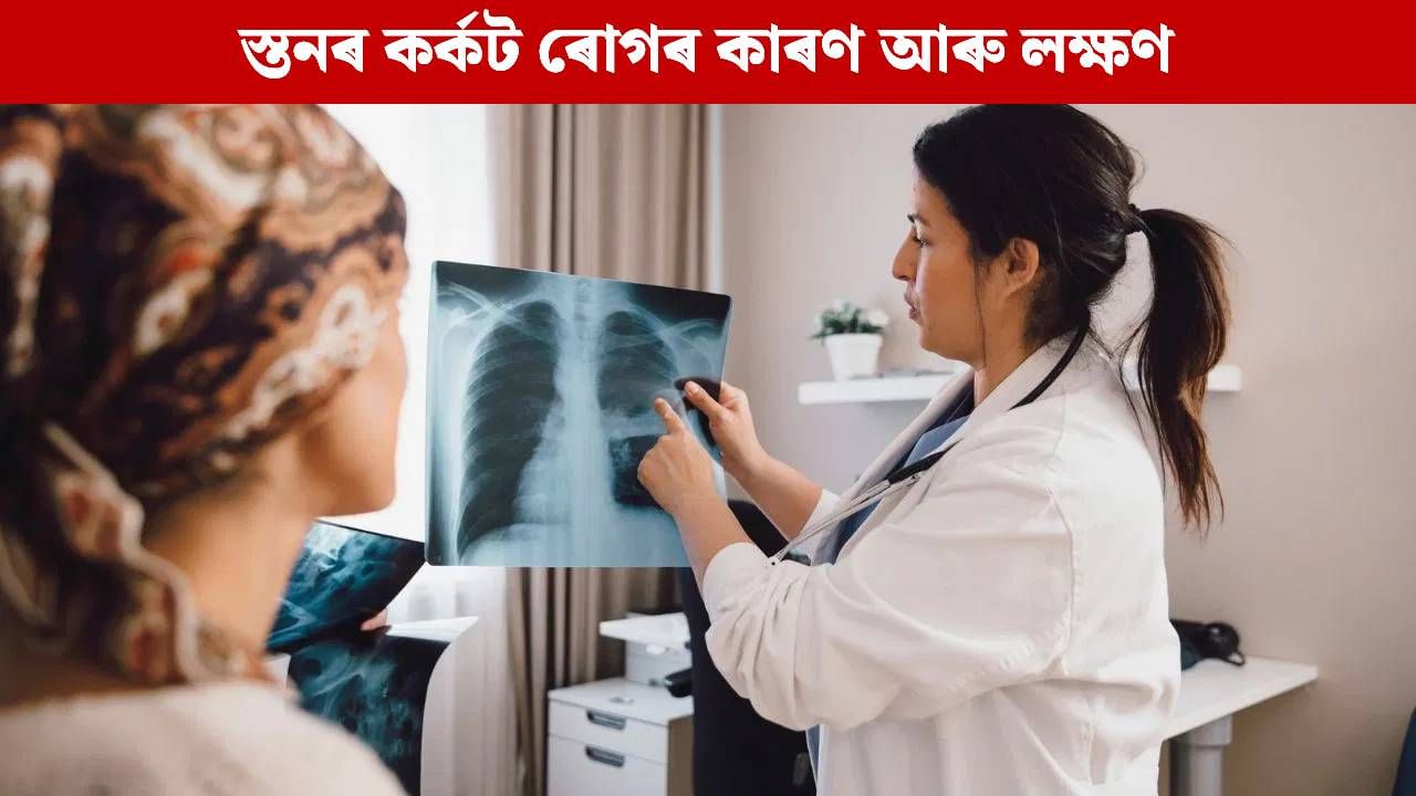 মেকআপৰ ব্যৱহাৰে বৃদ্ধি কৰে নেকি স্তনৰ কৰ্কট ৰোগৰ আশংকা? চিকিৎসকে কি কয় জানক… মেকআপৰ ব্যৱহাৰে বৃদ্ধি কৰে নেকি স্তনৰ কৰ্কট ৰোগৰ আশংকা? চিকিৎসকে কি কয় জানক…