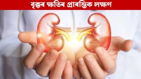 চকুত দেখা এই লক্ষণে দিয়ে বৃক্কৰ ক্ষতি হোৱাৰ ইংগিত, কি কৰিব? চকুত দেখা এই লক্ষণে দিয়ে বৃক্কৰ ক্ষতি হোৱাৰ ইংগিত, কি কৰিব?