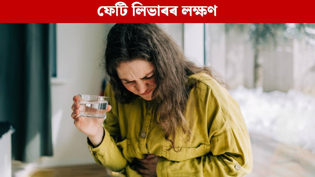 Fatty Liver: ছালত দেখা এই ৫টা লক্ষণে দিয়ে ফেটি লিভাৰ হোৱাৰ ইংগিত, জানক…