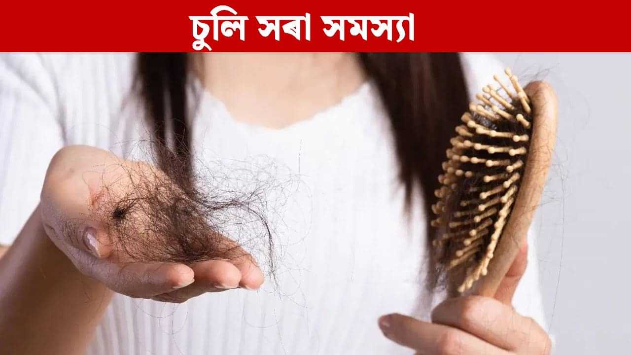 এই ৫ বিধ খাদ্যই বৃদ্ধি কৰে চুলি সৰা সমস্যা, নকৰিব ভুল... এই ৫ বিধ খাদ্যই বৃদ্ধি কৰে চুলি সৰা সমস্যা, নকৰিব ভুল...