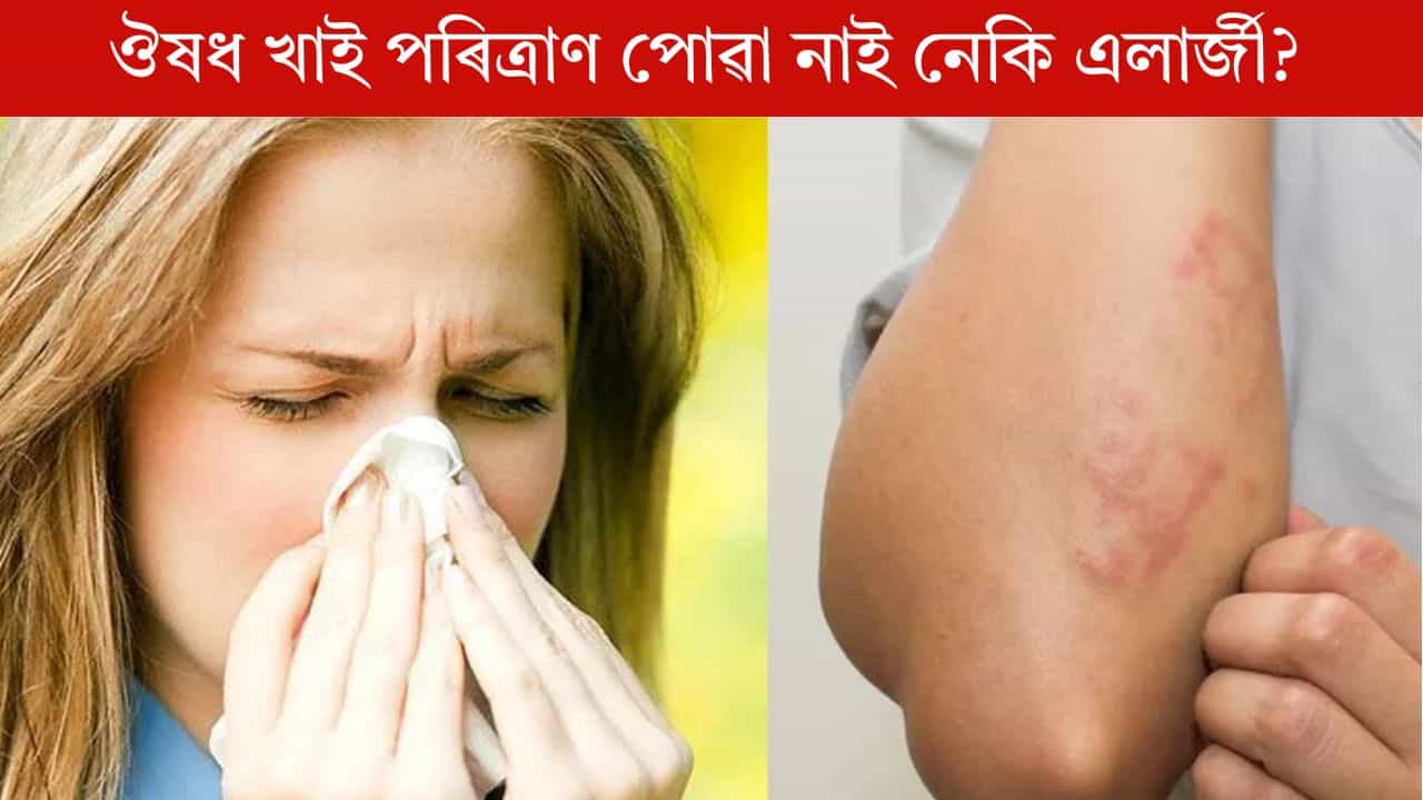বাৰে বাৰে এলাৰ্জীয়ে সমস্যাৰ সৃষ্টি কৰিছে নেকি? সহজ ঘৰুৱা উপায়েৰে কৰক দূৰ বাৰে বাৰে এলাৰ্জীয়ে সমস্যাৰ সৃষ্টি কৰিছে নেকি? সহজ ঘৰুৱা উপায়েৰে কৰক দূৰ