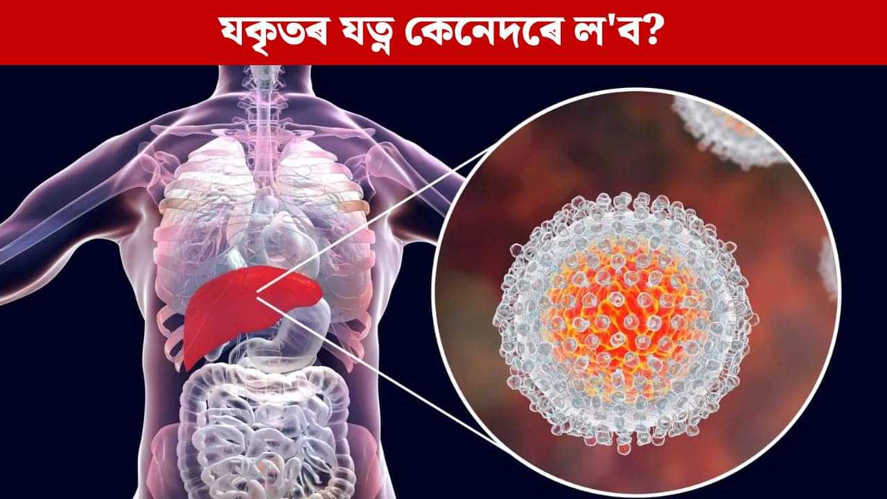 Liver: সুস্থ লিভাৰ বিচাৰেনে? গঢ়ি তোলক এই ৫টা অভ্যাস...
