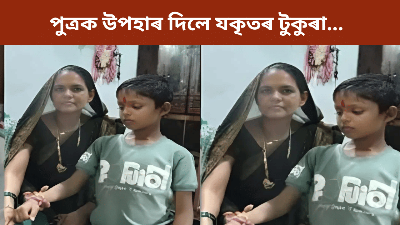 দেৱালীত পুত্ৰক উপহাৰ দিলে নতুন জীৱন! মাতৃয়ে দান কৰিলে যকৃতৰ টুকুৰা… দেৱালীত পুত্ৰক উপহাৰ দিলে নতুন জীৱন! মাতৃয়ে দান কৰিলে যকৃতৰ টুকুৰা…