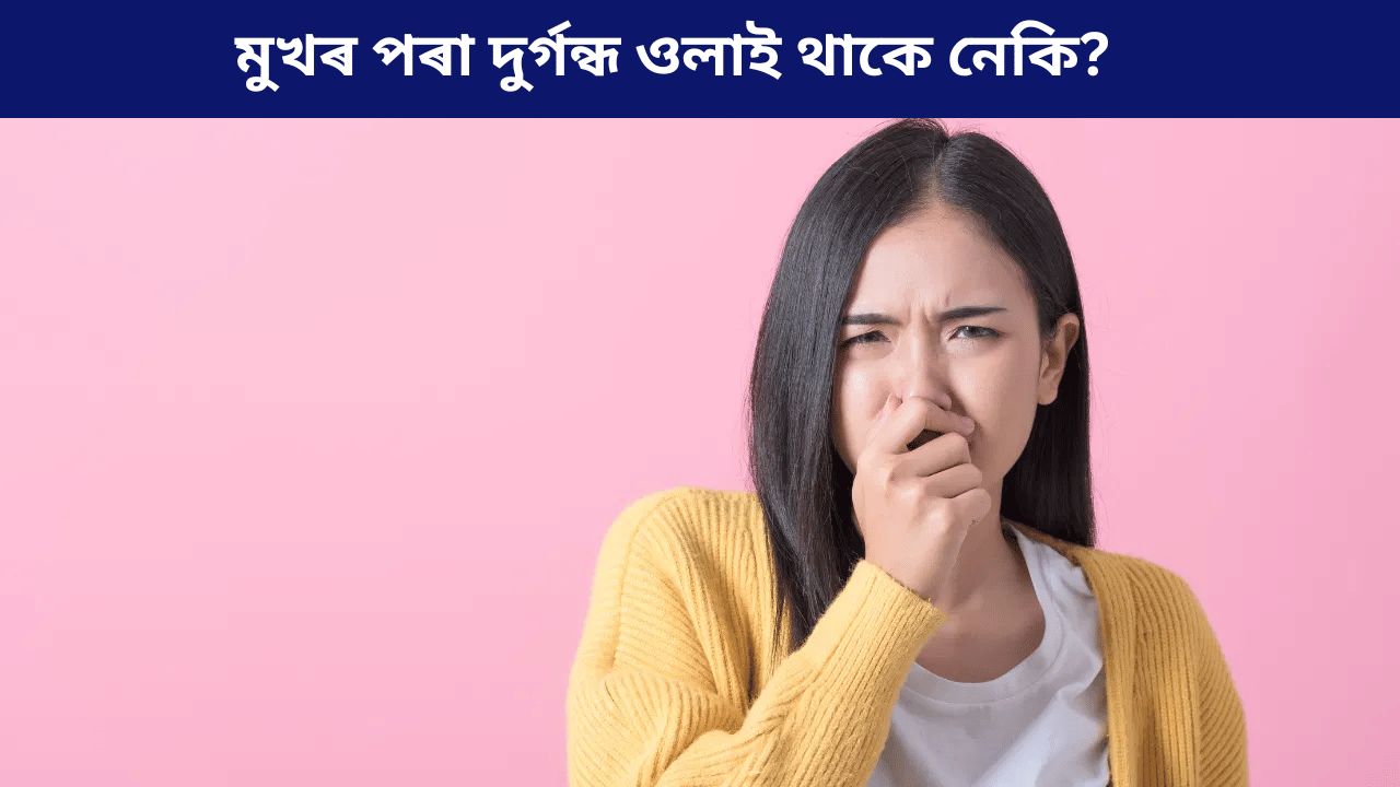জিভাত বগা দাগ পৰিছে নেকি? হ’ব পাৰে এই ডাঙৰ ৰোগৰ লক্ষণ, জানক চিকিৎসকৰ পৰা… জিভাত বগা দাগ পৰিছে নেকি? হ’ব পাৰে এই ডাঙৰ ৰোগৰ লক্ষণ, জানক চিকিৎসকৰ পৰা…
