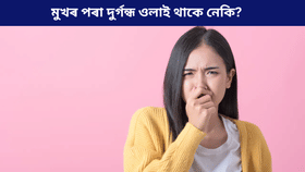 জিভাত বগা দাগ পৰিছে নেকি? হ'ব পাৰে এই ডাঙৰ সমস্যাৰ লক্ষণ, জানক... জিভাত বগা দাগ পৰিছে নেকি? হ'ব পাৰে এই ডাঙৰ সমস্যাৰ লক্ষণ, জানক...