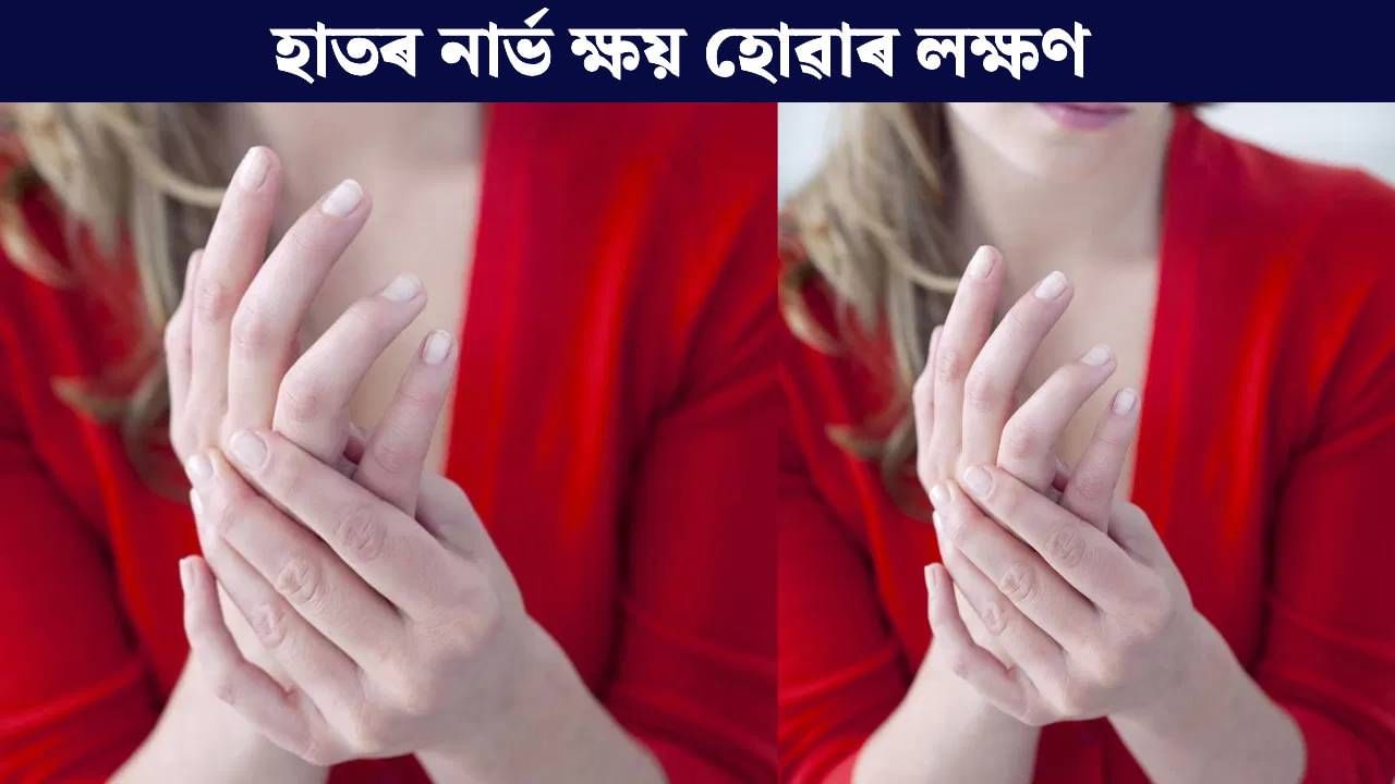 দুৰ্বল হৈ পৰিছে নেকি হাতৰ নাৰ্ভ, কেনেকৈ জানিব? আওকাণ নকৰিব এই লক্ষণ… দুৰ্বল হৈ পৰিছে নেকি হাতৰ নাৰ্ভ, কেনেকৈ জানিব? আওকাণ নকৰিব এই লক্ষণ…