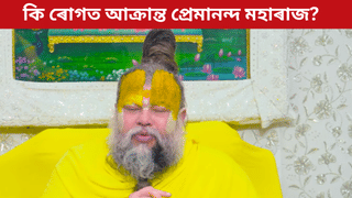 Premananda Maharaj: কিয় চকু-মুখ ফুলি গৈছে প্ৰেমানন্দ মহাৰাজৰ? এয়া কি ৰোগৰ লক্ষণ, জানক সকলো…
