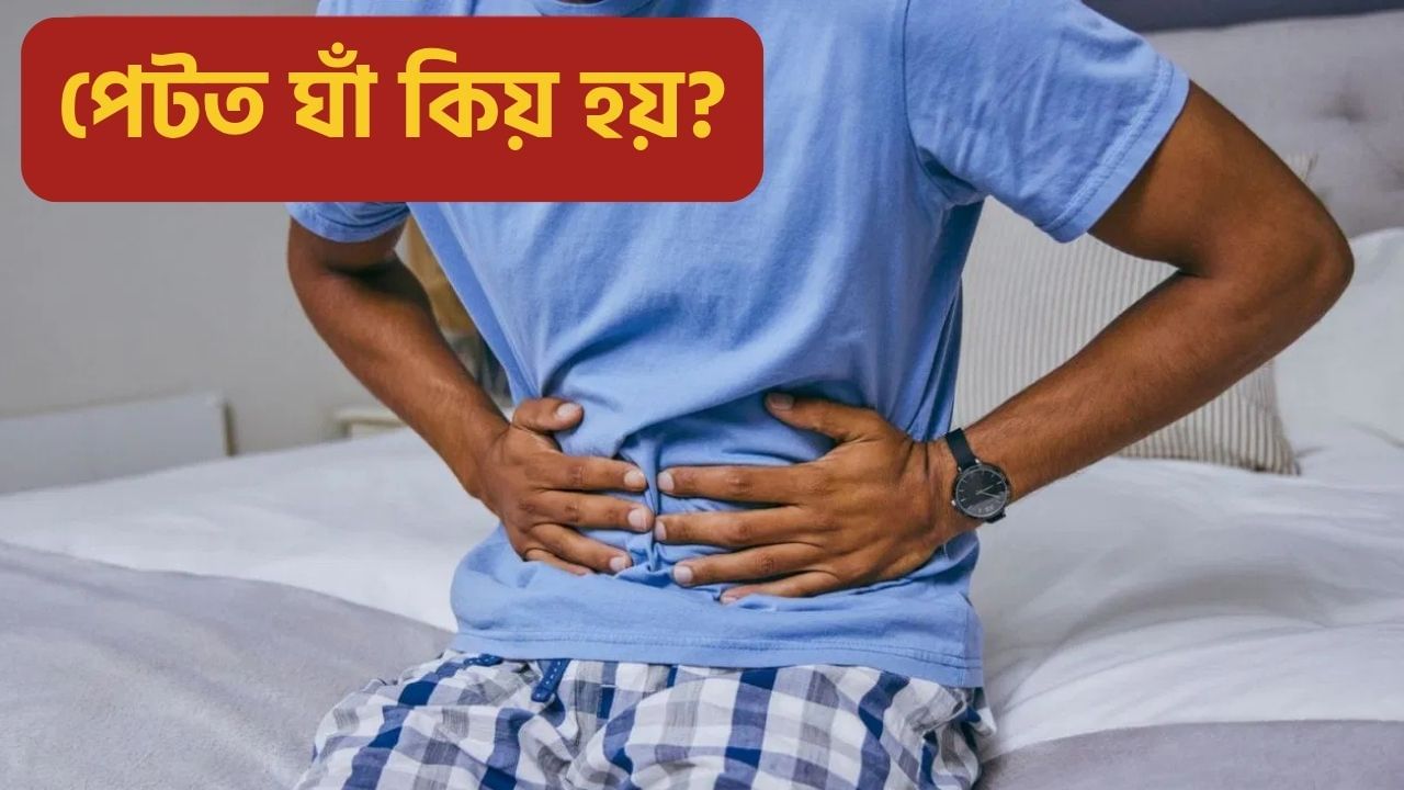 পেটৰ ভিতৰত ঘাঁ হ’লে শৰীৰে দিয়ে এইসমূহ ইংগিত, কাৰণ, প্ৰতিৰোধৰ উপায় জানক পেটৰ ভিতৰত ঘাঁ হ’লে শৰীৰে দিয়ে এইসমূহ ইংগিত, কাৰণ, প্ৰতিৰোধৰ উপায় জানক