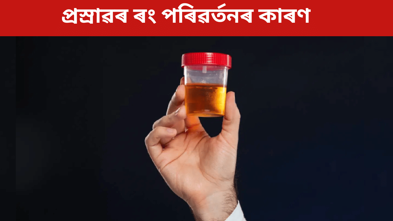 Urine Smell: ডায়েবেটিছৰ পৰা বৃক্কলৈ, প্ৰস্ৰাৱে দিয়ে এইসমূহ ৰোগৰ সংকেত! জানক… Urine Smell: ডায়েবেটিছৰ পৰা বৃক্কলৈ, প্ৰস্ৰাৱে দিয়ে এইসমূহ ৰোগৰ সংকেত! জানক…