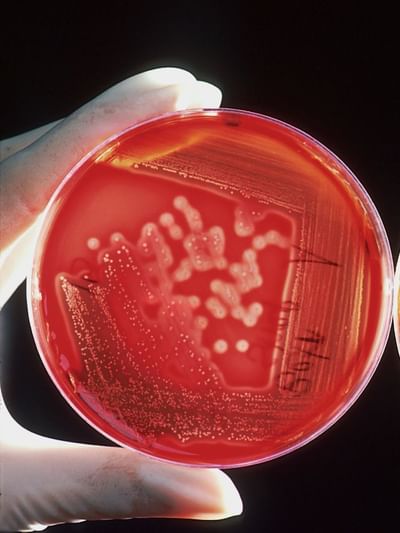 এনে লক্ষণে দেখা দিছে নেকি? সাৱধান, হ’ব পাৰে ব্লাড কেঞ্চাৰৰ পূৰ্বাভাস!