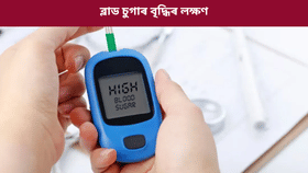 Blood Sugar Symptoms: ব্লাড চুগাৰ বৃদ্ধি পালে পুৱাৰ সময়ত কি কি লক্ষণে দেখা দিয়ে? জানক চিকিৎসকৰ পৰা…...
