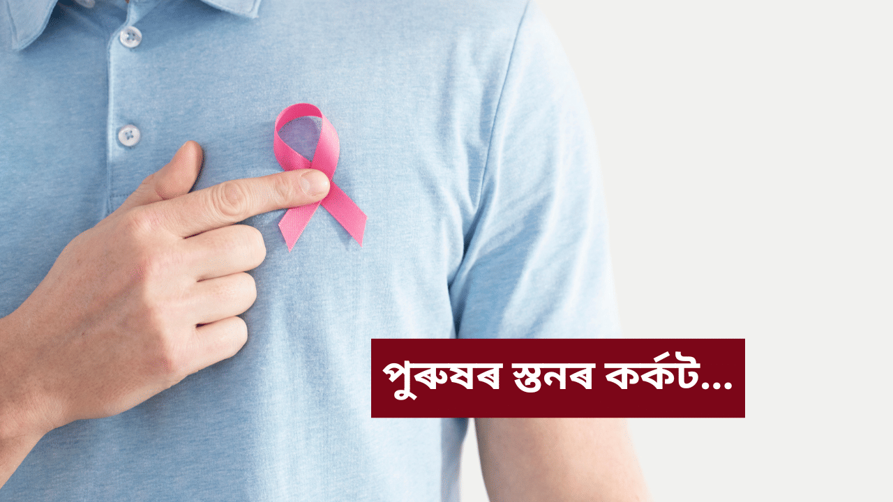 Breast cancer in Males : পুৰুষৰ মাজত বৃদ্ধি স্তনৰ কৰ্কট ৰোগ! কাৰণ, লক্ষণ আদি জনালে এইমছৰ চিকিৎসকে... Breast cancer in Males : পুৰুষৰ মাজত বৃদ্ধি স্তনৰ কৰ্কট ৰোগ! কাৰণ, লক্ষণ আদি জনালে এইমছৰ চিকিৎসকে...