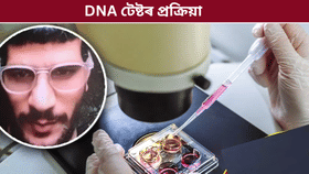 DNA পৰীক্ষা কি? ছিন্ন ভিন্ন মৃতদেহৰ পৰা কেনেকৈ সংগ্ৰহ কৰে নমুনা