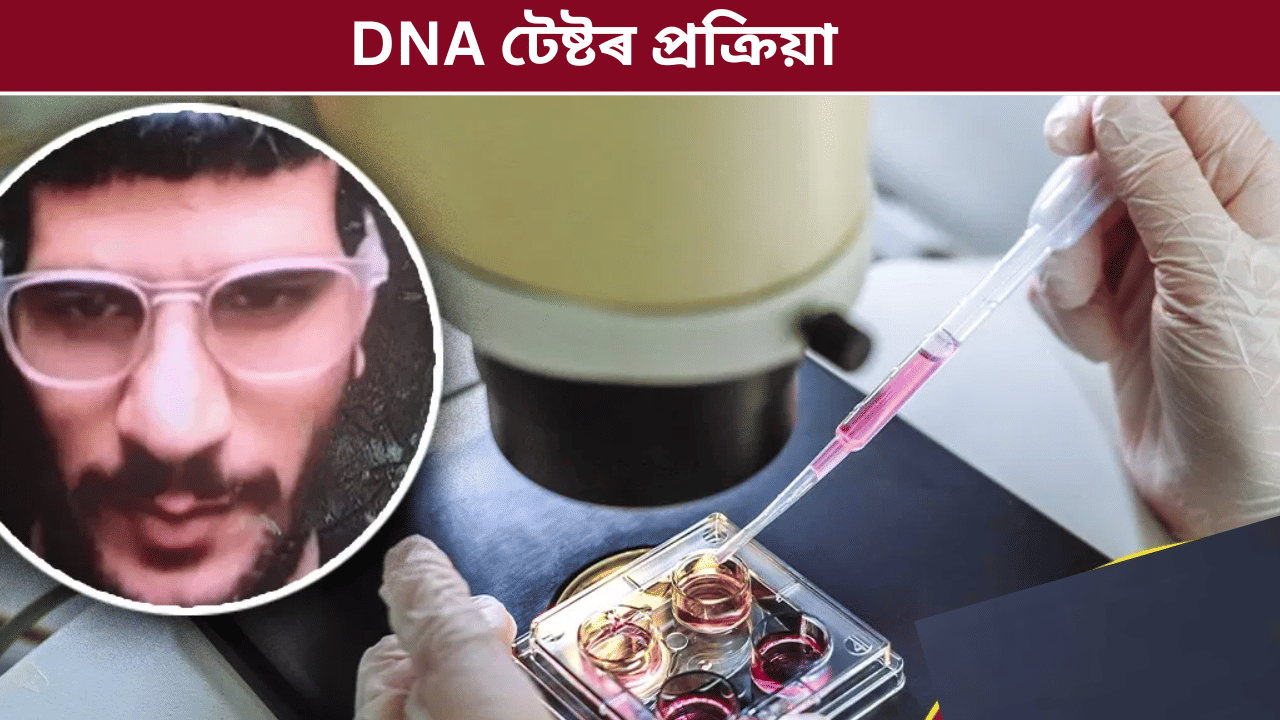 DNA পৰীক্ষাত ওমৰ চিনাক্ত! ছিন্ন ভিন্ন মৃতদেহৰ পৰা কেনেকৈ সংগ্ৰহ কৰে নমুনা? জানক সকলো... DNA পৰীক্ষাত ওমৰ চিনাক্ত! ছিন্ন ভিন্ন মৃতদেহৰ পৰা কেনেকৈ সংগ্ৰহ কৰে নমুনা? জানক সকলো...