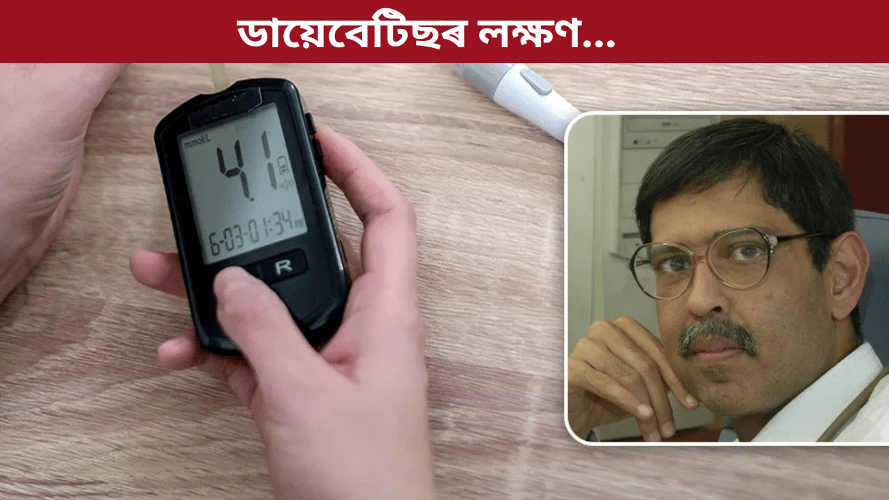 ডায়েবেটিছৰ প্ৰাৰম্ভিক লক্ষণসমূহ কি কি? জানক এইমছৰ চিকিৎসকৰ পৰা... ডায়েবেটিছৰ প্ৰাৰম্ভিক লক্ষণসমূহ কি কি? জানক এইমছৰ চিকিৎসকৰ পৰা...