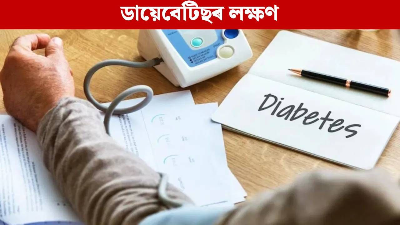 Blood Suger: ব্লাড চুগাৰ বৃদ্ধি হ’লে শৰীৰে দিয়ে এইসমূহ সাধাৰণ ইংগিত, আওকান নকৰিব…