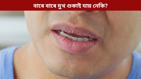 নিশা শুৱাৰ পাছত বাৰে বাৰে মুখ শুকাই যায় নেকি? জানক কাৰণ...
