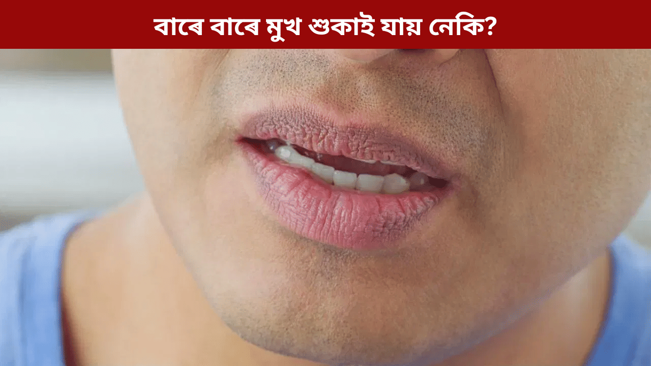 নিশা শুৱাৰ পাছত বাৰে বাৰে মুখ শুকাই যায় নেকি? এয়া কিহৰ লক্ষণ, জানক... নিশা শুৱাৰ পাছত বাৰে বাৰে মুখ শুকাই যায় নেকি? এয়া কিহৰ লক্ষণ, জানক...