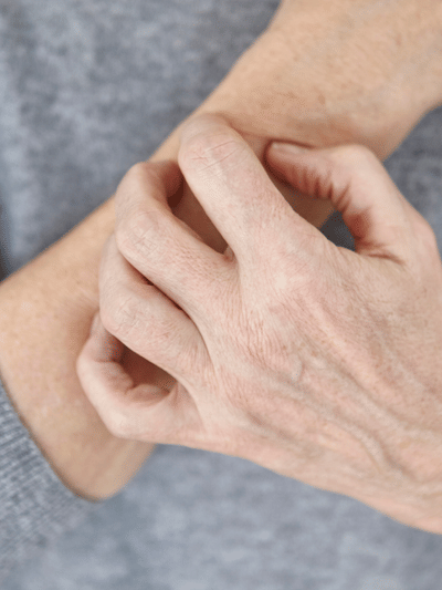 বাৰে বাৰে ছালত খজুৱতি হৈ থকাৰ কাৰণ কি? জানক বিশেষজ্ঞৰ পৰা…