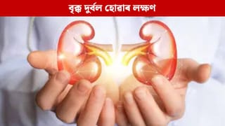Kidney: শৰীৰৰ এই ৪টা লক্ষণে দিয়ে বৃক্ক দুৰ্বল হোৱাৰ ইংগিত, আওকান নকৰিব…