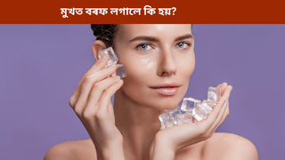 Skin Care: বৰফৰ পানীত মুখ তিয়াই ৰাখিলে কি লাভ হয়? জানক বিশেষজ্ঞৰ পৰা…