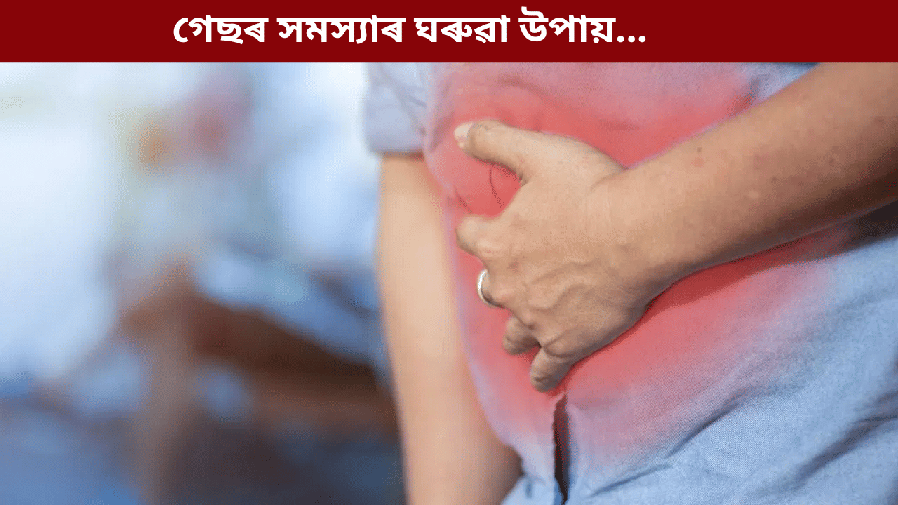 প্ৰায়ে গেছৰ সমস্যা হয় নেকি? এই সহজ ঘৰুৱা উপায়ে দিব সমাধান…