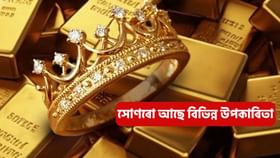 সোণ পৰিধান কৰিলে নাইকীয়া হ'ব ৰোগ!