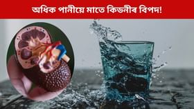 অধিক পানীয়ে বিপদ মাতে কিডনীলৈ, এই পৰিমাণতকৈ বেছি খালেই সমস্যা!