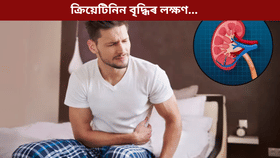 বৃক্কত ক্ৰিয়েটিনিন বৃদ্ধি পালে শৰীৰে দিয়ে এইসমূহ ইংগিত! জানক