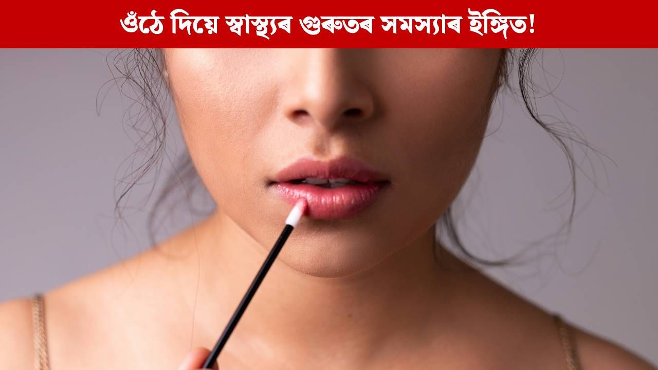 আপোনাৰ ওঁঠে দিয়ে স্বাস্থ্যৰ গুৰুতৰ সমস্যাৰ ইঙ্গিত, এই ৬টা লক্ষণ দেখিলেই হওক সাৱধান