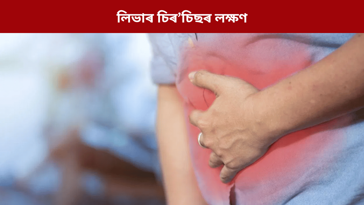 Liver Cirrhosis: লিভাৰ চিৰচি’ছ হ’লে কি কি লক্ষণে দেখা দিয়ে? জানক চিকিৎসকৰ পৰা…