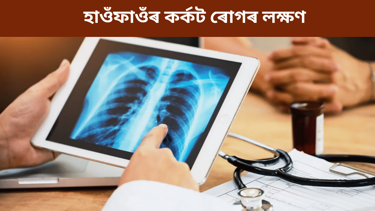 Lungs Cancer Symptoms: হাওঁফাওঁৰ কৰ্কট ৰোগ হলে কি কি লক্ষণে দেখা দিয়ে? জানক চিকিৎসকৰ পৰা....