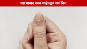নখৰ বগা দাগে কিডনী বা হৃদৰোগৰ ইংগিত দিয়ে নেকি ?