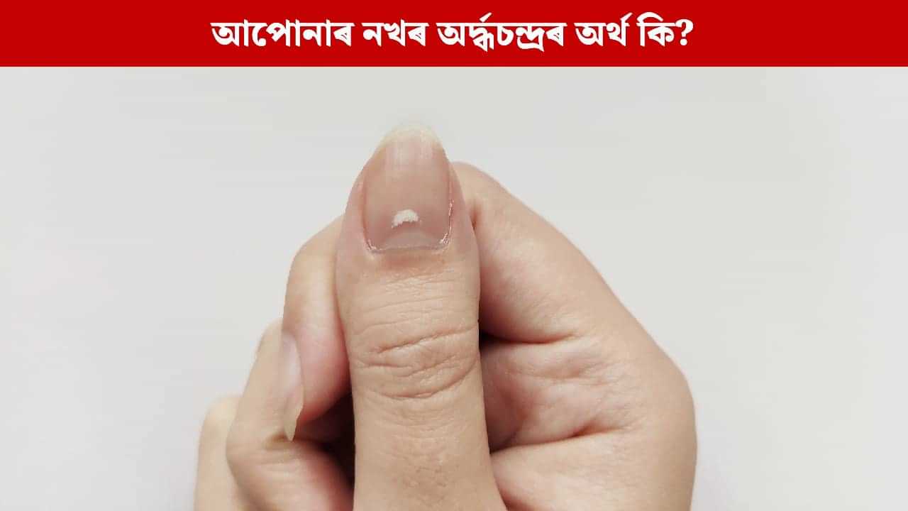 নখৰ বগা দাগে কিডনী বা হৃদৰোগৰ ইংগিত দিয়ে নেকি ?