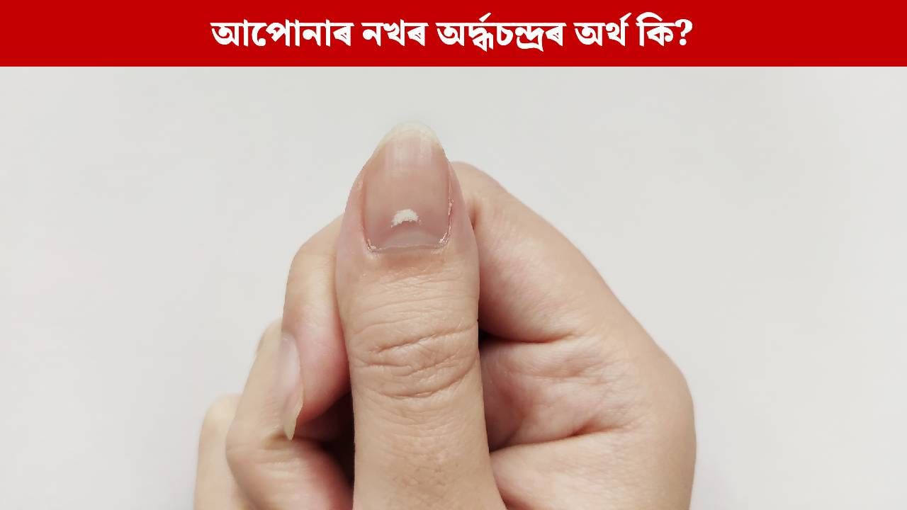 নখৰ বগা দাগে কিডনী বা হৃদৰোগৰ ইংগিত দিয়ে নেকি ?