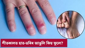 ঠাণ্ডাৰ দিনত ভৰি-হাতৰ আঙুলি ফুলি উঠে নেকি? এই কামৰ কৰক...