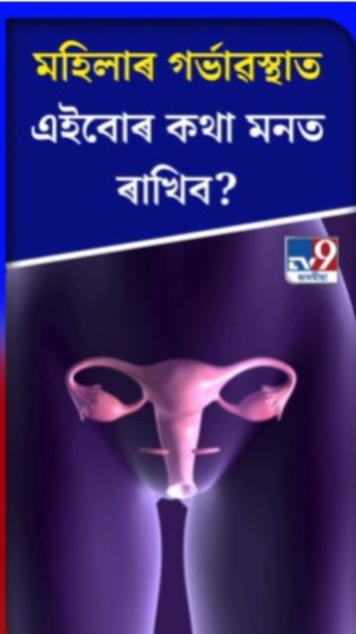 মহিলাই গৰ্ভৱস্থাত কি কি কথা মনত ৰাখিব লাগে?