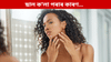 কি ভিটামিনৰ অভাৱত ছাল ক'লা পৰে? জানক......