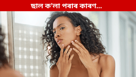 কি ভিটামিনৰ অভাৱত ছাল ক'লা পৰে? জানক...