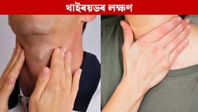 শৰীৰৰ এই অংশসমূহত বিষ অনুভৱ কৰে নেকি? হ'ব পাৰে থাইৰয়ডৰ ইংগিত...