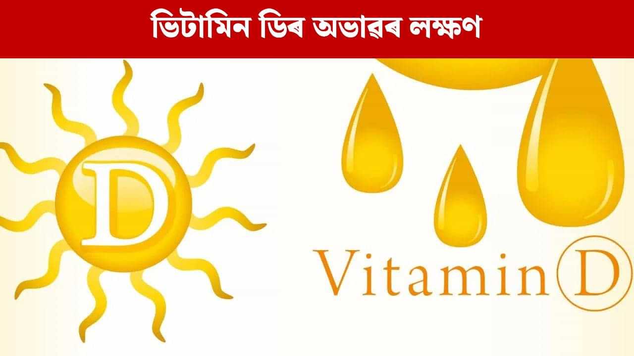 হাত-ভৰি বিষ, ভাগৰুৱা অনুভৱ কৰিছে নেকি ? এই সমস্যা কিয় হয়? হাত-ভৰি বিষ, ভাগৰুৱা অনুভৱ কৰিছে নেকি ? এই সমস্যা কিয় হয়?