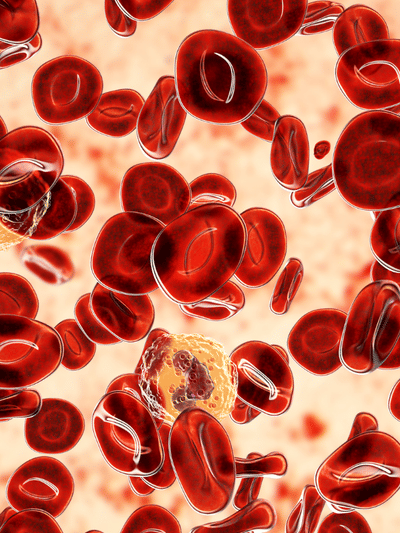 থেলাছেমিয়া ৰোগৰ লক্ষণ আৰু কাৰণ কি, জানক সকলো…