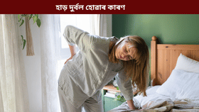 আপোনাৰ এই ৫ টা সাধাৰণ অভ্যাসে দুৰ্বল কৰিব পাৰে হাড়! জানক সকলো…...