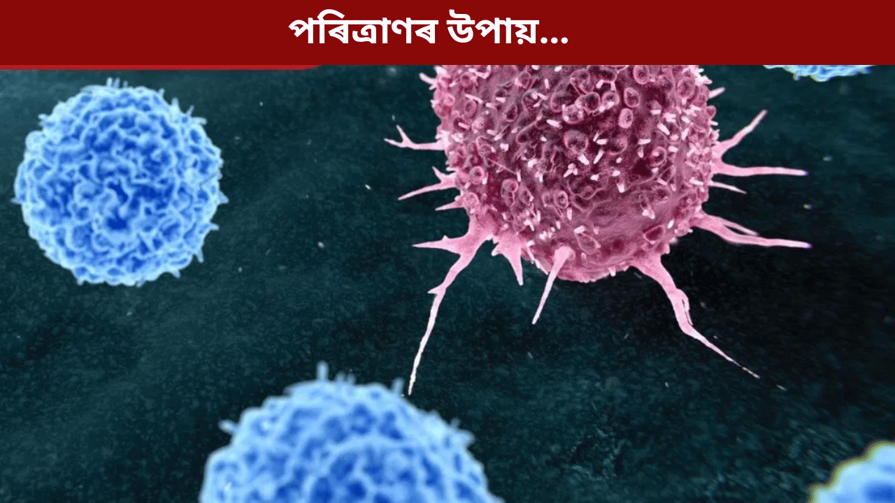 কৰ্কট ৰোগৰ পৰা হাত সাৰিবলৈ কি কৰিব লাগে? জানক চিকিৎসকৰ পৰা... কৰ্কট ৰোগৰ পৰা হাত সাৰিবলৈ কি কৰিব লাগে? জানক চিকিৎসকৰ পৰা...