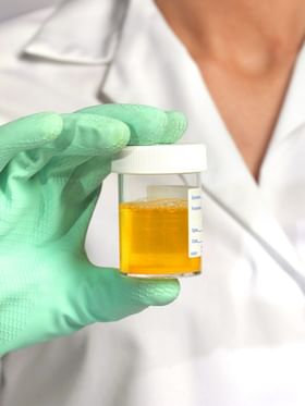 ঔষধ খোৱাৰ প্ৰয়োজন নাই, ইউৰিক এচিডৰ মাত্ৰা নিয়ন্ত্ৰণ কৰাৰ ৫ টা ঘৰুৱা উপায় জানক...