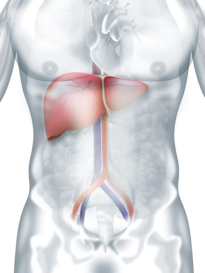 আপুনি ফেটি লিভাৰত আক্ৰান্ত নেকি? উপশম পাবলৈ দৈনিক এই পানীয় সেৱন কৰক