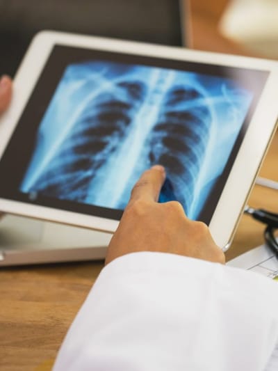 কাহ, শ্বাস-প্ৰশ্বাসৰ সমস্যা নে হঠাতে ওজন কমি যোৱা? হাওঁফাওঁৰ কৰ্কট ৰোগৰ লক্ষণবোৰ জানক