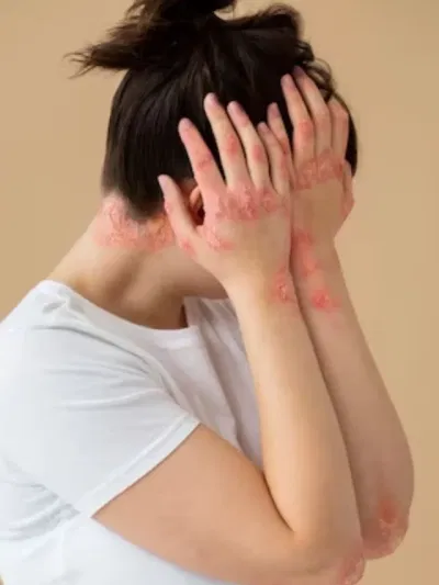 শৰীৰত ভেঁকুৰৰ সংক্ৰমণৰ প্ৰাৰম্ভিক লক্ষণসমূহ কি কি? চিকিৎসকৰ পৰা জানক…