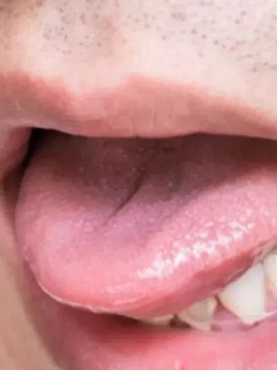 জিভাত বাৰে বাৰে ঘাঁ হয় নেকি? কাৰণ জানক..