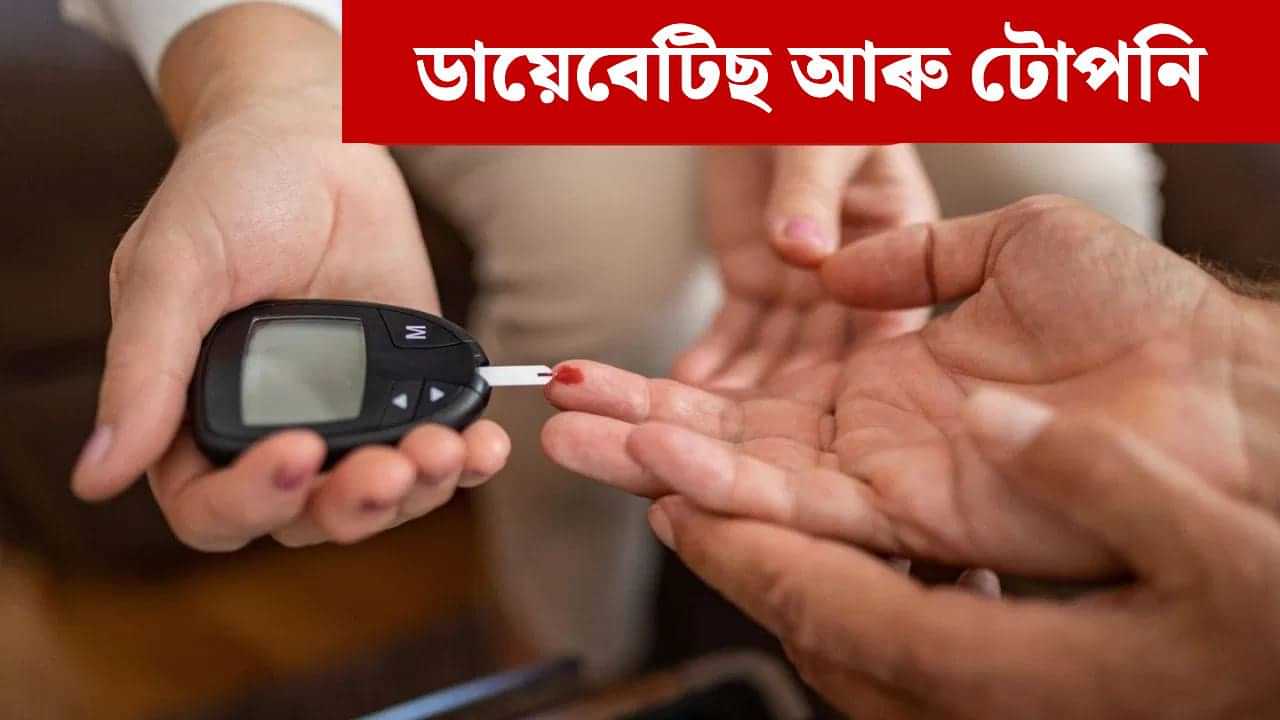 Blood Suger: ব্লাড চুগাৰ বৃদ্ধিয়ে টোপনিক প্ৰভাৱিত কৰে নেকি? জানক চিকিৎসকৰ পৰা... Blood Suger: ব্লাড চুগাৰ বৃদ্ধিয়ে টোপনিক প্ৰভাৱিত কৰে নেকি? জানক চিকিৎসকৰ পৰা...